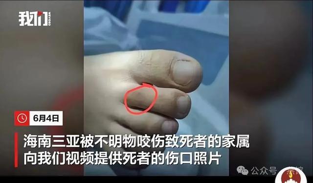 事件那些忽视的真相！必一运动三亚毒蛇咬人